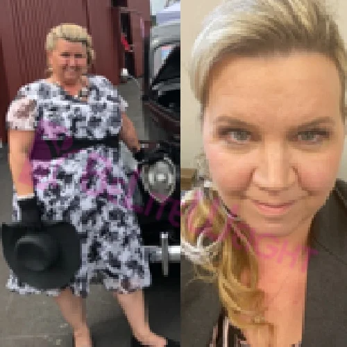 Julie K - 1 Year Update*